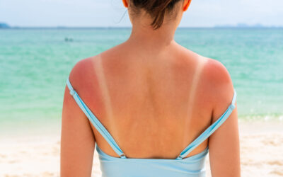 Bonnie’s Picks Episode #20 – Sunscreen – Don’t leave home without it!